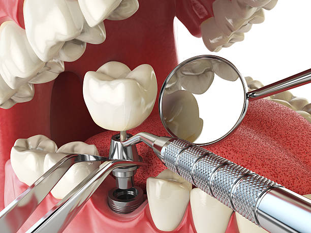 Best Emergency Dental Services for Seniors in Aurora, SD